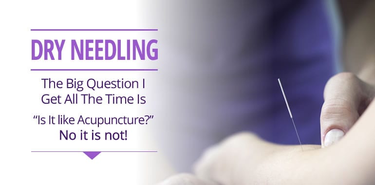 Dry Needling